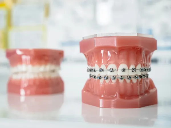 Invisalign & Braces